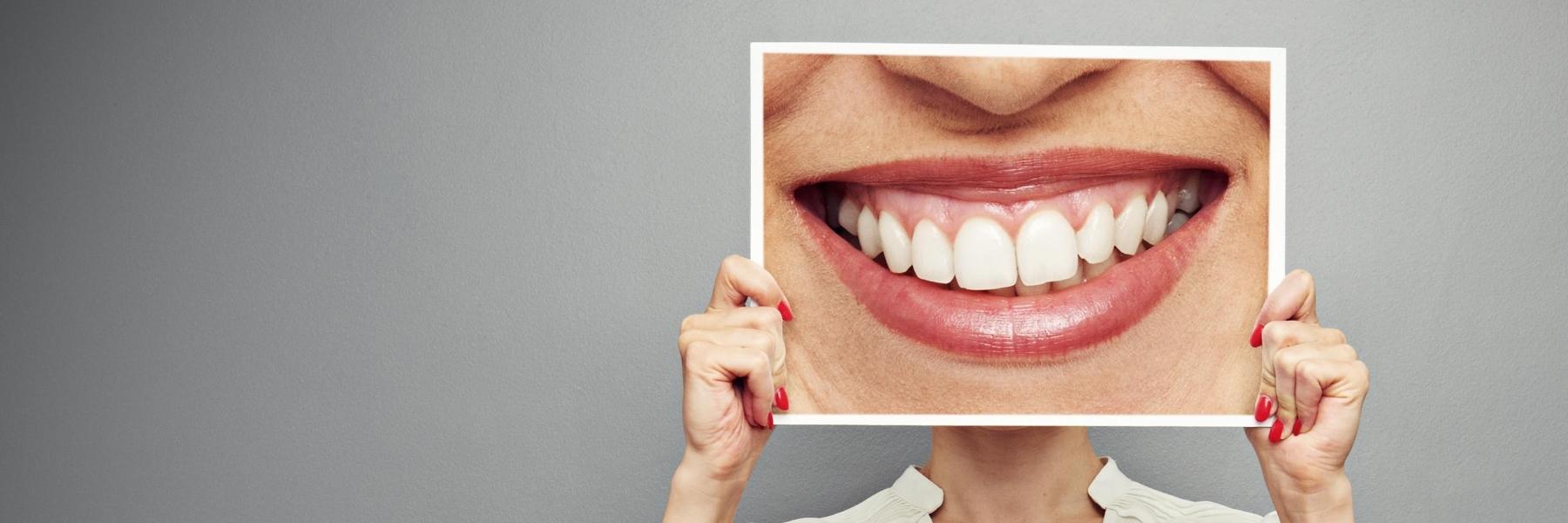 Dental Examination | Dentist