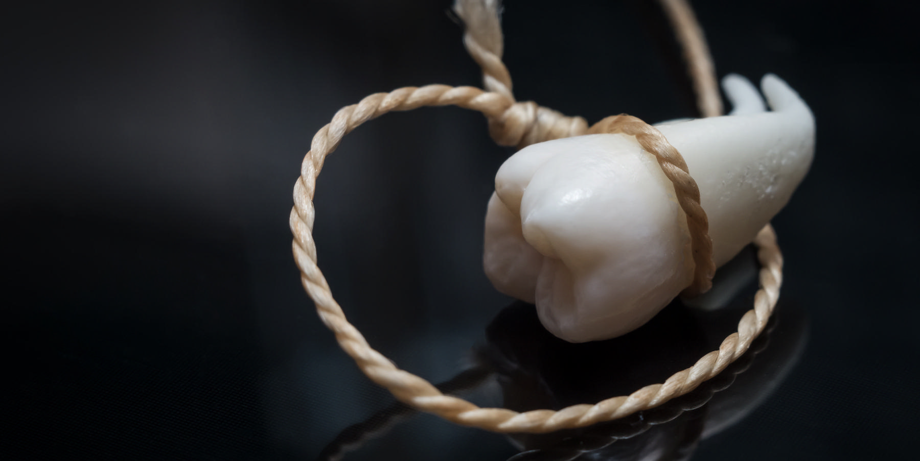 Wisdom Teeth | Dentist
